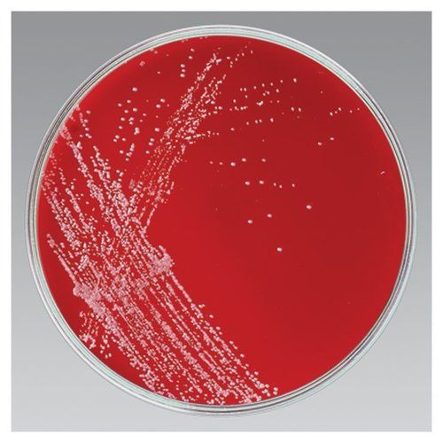 BORDET GENGOU AGAR (Sheep Blood 15%)