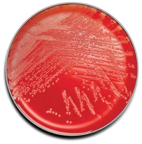 COLUMBIA AGAR (Sheep Blood 5%)