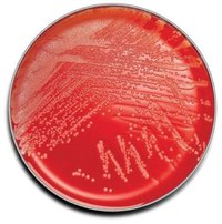 COLUMBIA AGAR (Sheep Blood 5%)