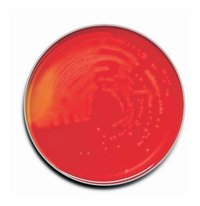 TRYPTIC SOY AGAR (Horse Blood 5%)