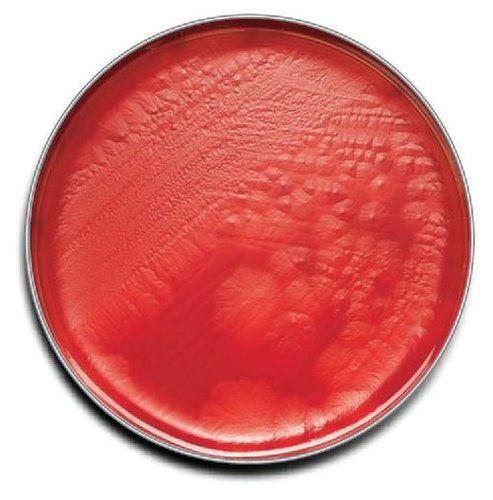 AZIDE AGAR (Sheep Blood 5%)