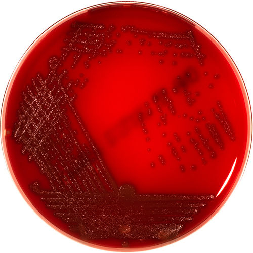 GARDNERELLA AGAR (Sheep Blood 5%)