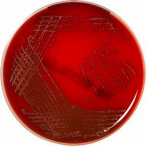 SCHAEDLER K AGAR (Sheep Blood 5%)