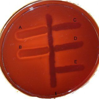 COLUMBIA AGAR(Sheep Blood 5%)+VANCOMYCIN