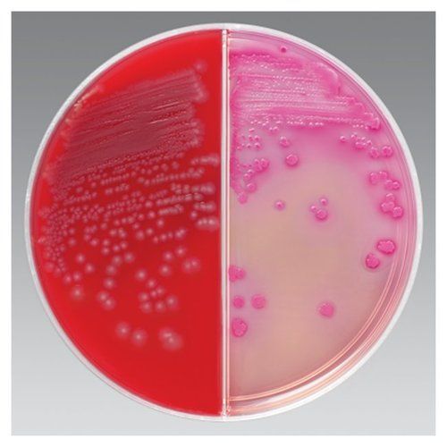 TSA BLOOD/CHROMATIC DETECTION