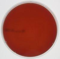 BLOOD AGAR BASE