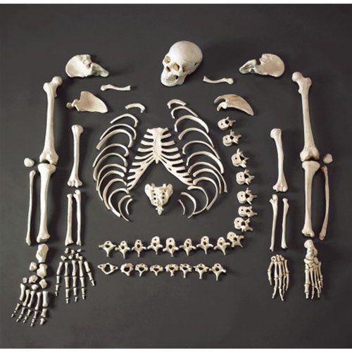 Disarticulated Life Size Skeleton For Mbbs Students Consists Of Approx 200 Bones