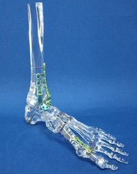 Clear Foot Models With Implants