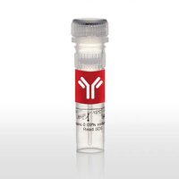 CD35 Monoclonal Antibody(AF488 Conjugated)[E11]