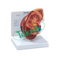 Human Kidney Model - 320x230x100 Mm | Detailed Renal Calyx And Nephron Structures