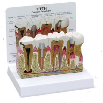 Tooth Models