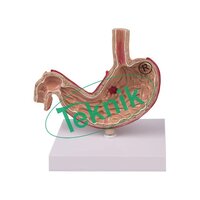 Human Stomach Model - 7.75" X 2.25" X 6.25" Life-size Anatomical Representation, Features Cancerous Ulcer & Oesophageal Inflammation