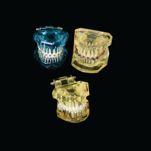 Dental Orthodontic Jaw Model