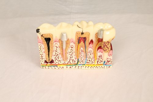 Three Tooth Model