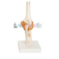 Elbow Joint (model)