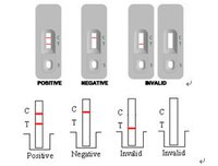 Treponema Pallidum(TP) antibody Cassette