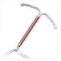 Copper T  intra uterine device