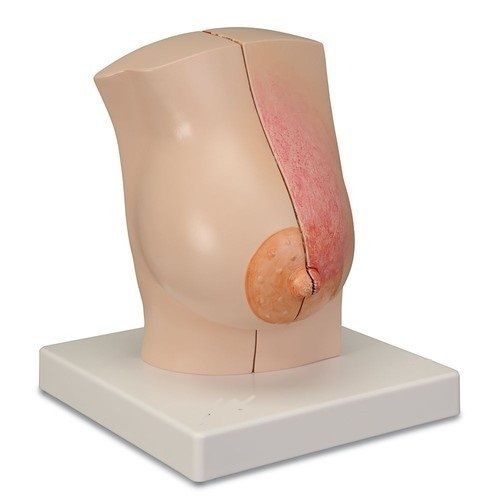 Female Breast Model