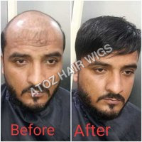 Multicolors Available Hair Wigs Delhi