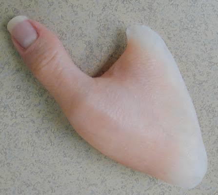 Silicone Finger prosthesis