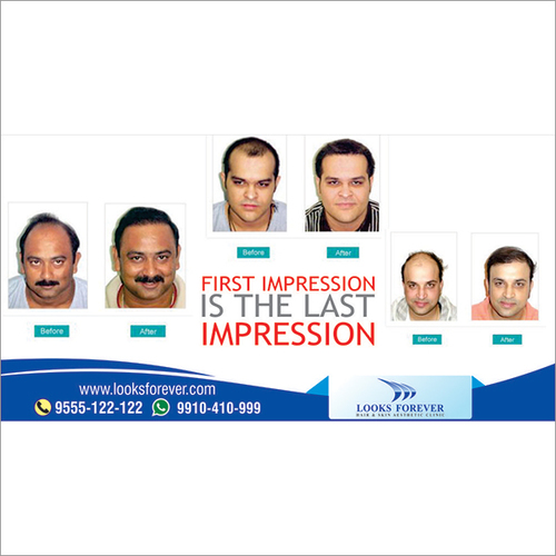 Hairskeen Custom Mena s Hair Replacement