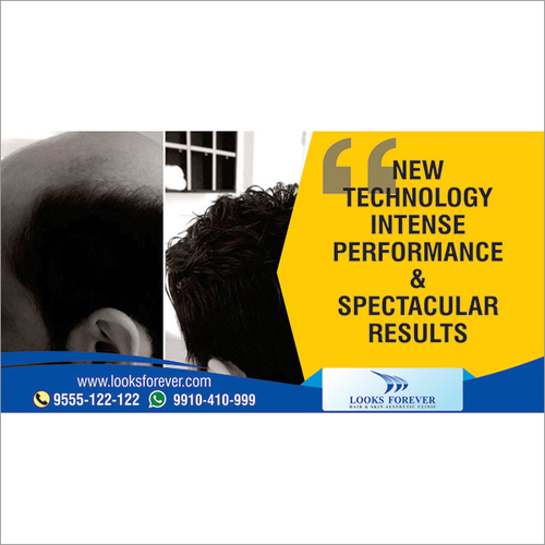 Intense Performance Hair Replacement