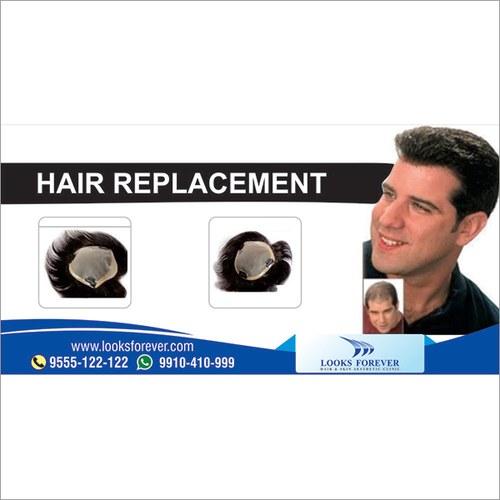 Men's Non-Surgical Hair Replacement