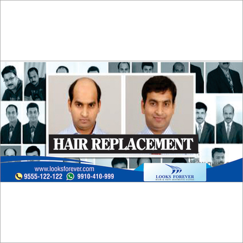 Non-Surgical Hair Replacement