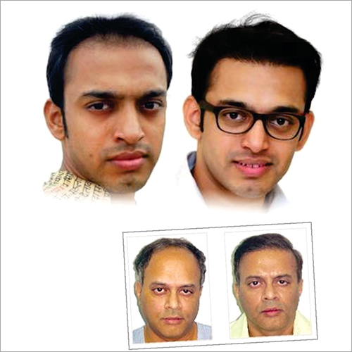Mirage Hair Skin at Best Price in New Delhi, Delhi | Looks Forever Mirage Hair Skin at Best Price in New Delhi, Delhi | Looks Forever