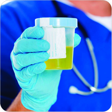 Urine Culture Bottle