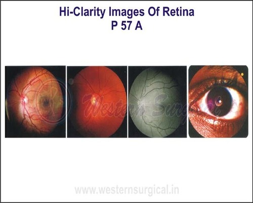 Hi-Clarity Images of Retina By WESTERN SURGICAL