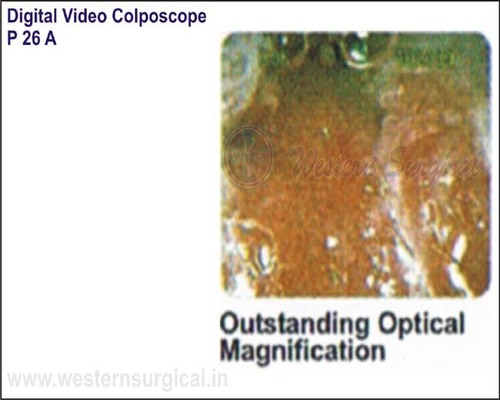 Digital Video Colposcope (Outstanding Optical Magnification)