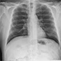 Quality Assurance & Testing Of X-ray Services - Hvl Filtration Test, Air Kerma Measurement, Ctdi Measurement, Aerb Compliant Reporting | Reliable, Timely Execution, High Demand