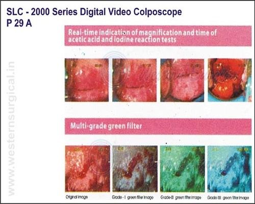 SLC - 2000 Series Digital Video Colposcope