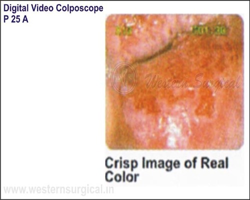 Digital Video Colposcope (Crisp Image Of Real Color)