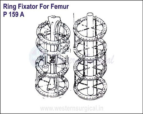 Ring Fixator For FEMUR