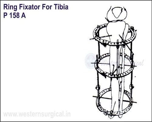 Ring Fixator For Tibia