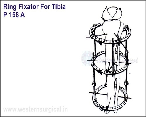 Ring Fixator For TIBIA