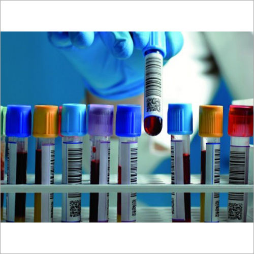 Blood Collection Tubes Application: Used In Hospital