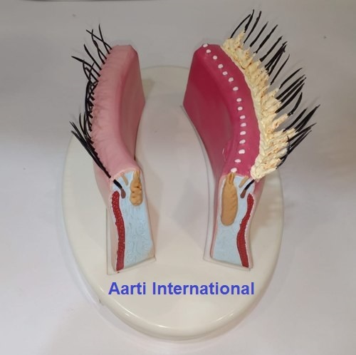 Red Brown Diseased Eye Model (Blepharitis Model)