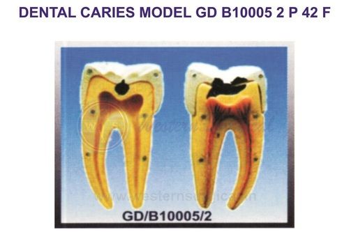 DENTAL CARIES MODEL GD B10005