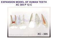 Expansion Model Of Human Teeth Xc 305 - High-quality Plastic, Standard Size, White With Color-coded Layers | Pre-assembled, Detailed Anatomical Structure