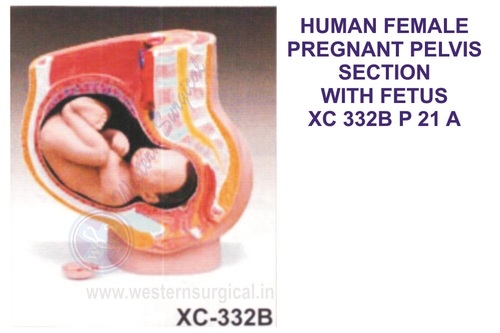 HUMAN FEMALE PREGNANT PELVIS SECTION WITH FETU