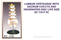 LUMBAR VERTEARAE WITH SACRUM COCCYX AND HEARINATED DISC
