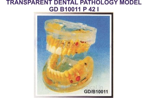 TRANSPARENT DENTAL PATHOLOGY MODEL