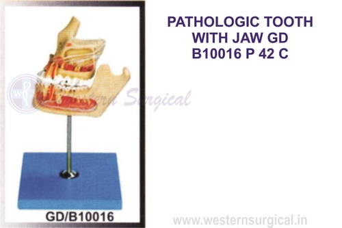 PATHOLOGIC TOOTH WITH JAW