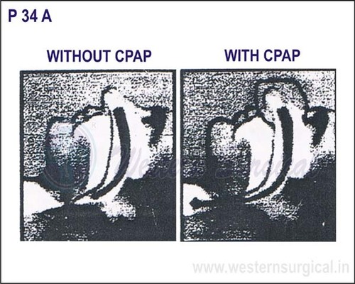 WITHOUT CPAP & WITH CPAP