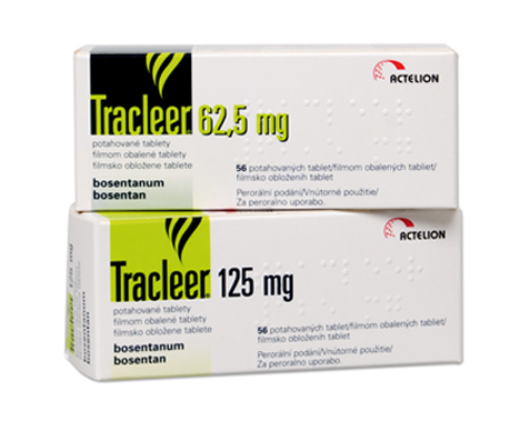 Tracleer Tablets Bosentan General Medicines