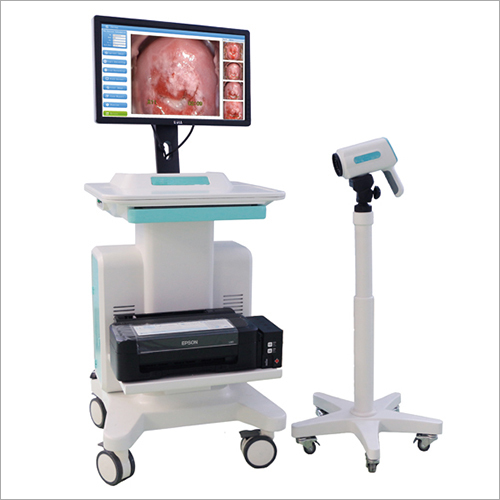 Digital Colposcope