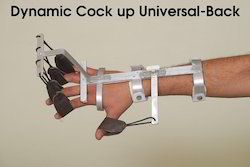 dynamic cockup splint